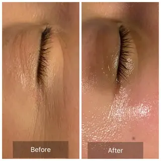 Mandarin Orange所属・毛穴から始める肌メン テマンダリンオレンジのエステ・リラクイメージ