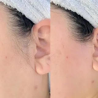 メンズ salonLADYSTYLE所属・稲嶺 美華のエステ・リラクイメージ