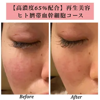 Bellesthe (ベルエステ)のエステ・リラクイメージ