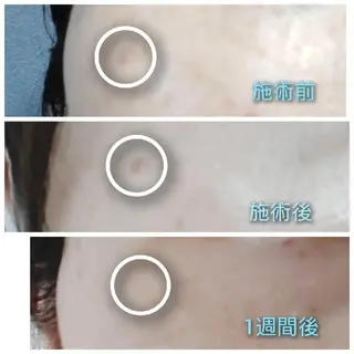 Beauty Salon Luana所属・Luanaまつパ脱毛 ハーブピーリング眉毛のマツエク・マツパデザイン