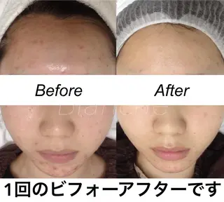 ショート カラー パーマ ネイル マツエク・マツパ 都度払い肌質改善 &脱毛Blancheのエステ・リラクイメージ