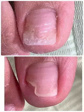 ネイル Chérinail 爪のお手入れのネイルデザイン