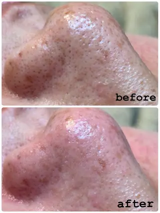 sourire.11 ‪☺︎‬‪emiのエステ・リラクイメージ