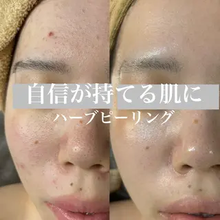 WHITE AQUA 北千住店のエステ・リラクイメージ