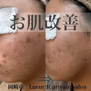 大久保 里奈のエステ・リラクイメージ