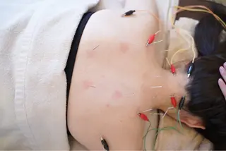 美容鍼サロンメゾンブランシェ所属・🌸美容鍼サロン🌸 メゾンブランシェ🌈のエステ・リラクイメージ