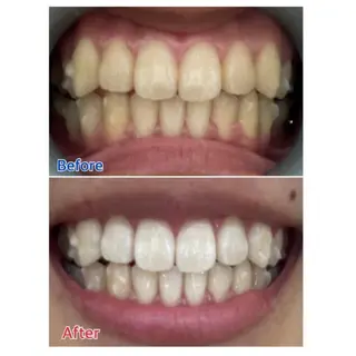 M渋谷店所属・M渋谷 ホワイトニングのエステ・リラクイメージ