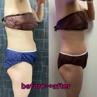 Salon Improveのネイルデザイン