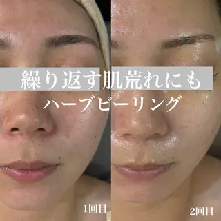 WHITE AQUA 北千住店のエステ・リラクイメージ