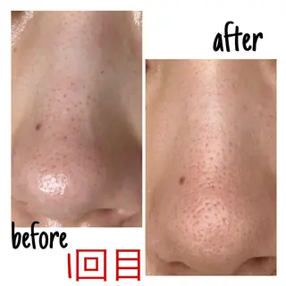 アルカンジュ~archange~所属・痩身/毛穴洗浄/脱毛 アルカンジュのエステ・リラクイメージ