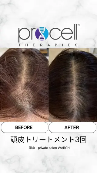 WARCH Marieのその他イメージ