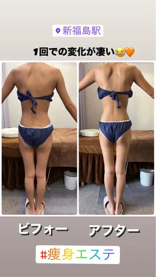 ロング FLEUR大阪・整体 ・ハイフ・痩身・小顔のエステ・リラクイメージ