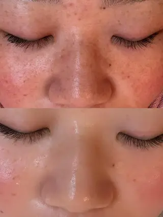 Luana武蔵小杉店 (ルアナ)のその他イメージ