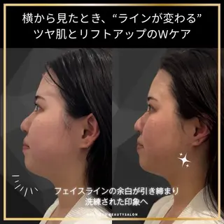 NANI OAFU所属・NANIOAFU [なんば店］のエステ・リラクイメージ