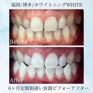 ホワイトニングサロン WHITE福岡博多店のエステ・リラクイメージ