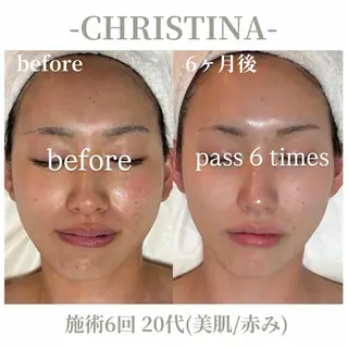 肌質改善|天王寺 For...はるかのエステ・リラクイメージ