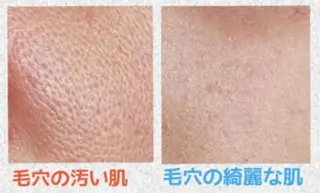 ニキビ・ 肌荒れ専門店のエステ・リラクイメージ