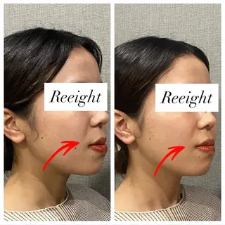 肌質改善専門 ハーブ /毛穴洗浄 リエイトのエステ・リラクイメージ