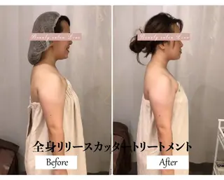 痩身×フェイシャル ブライダル|Linoのエステ・リラクイメージ