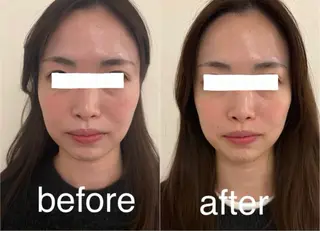 美容鍼灸サロン mahoroba院長のエステ・リラクイメージ