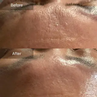 Mandarin Orange所属・毛穴から始める肌メン テマンダリンオレンジのエステ・リラクイメージ