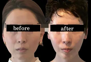 小顔/たるみ/黒ずみ除去専門サロン/SONA 大和西大寺店所属・【小顔専門看護師 サロンSONA】のエステ・リラクイメージ