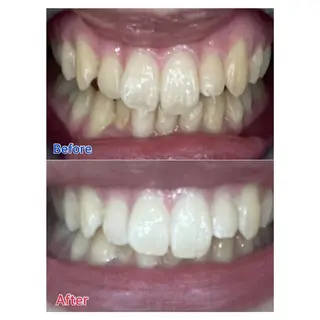 MBEAUTYSALON 千葉店・京成大久保所属・Melty 輝のその他イメージ