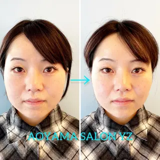 小顔美容鍼専門サロン 渋谷YZのエステ・リラクイメージ