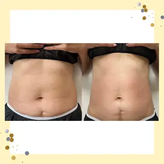 Beauty   Salon  Adiy所属・Adiy ikumiのエステ・リラクイメージ