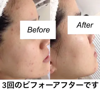 都度払い肌質改善 &脱毛Blancheのエステ・リラクイメージ