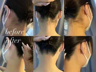 うなじ脱毛/美肌脱毛 LABELのエステ・リラクイメージ