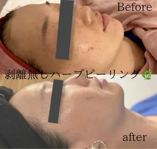 Care Salon COCO 【自由が丘店】所属・看護師施術サロン🍃 夢乃のエステ・リラクイメージ