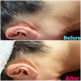 透明感の肌Lino malieのエステ・リラクイメージ