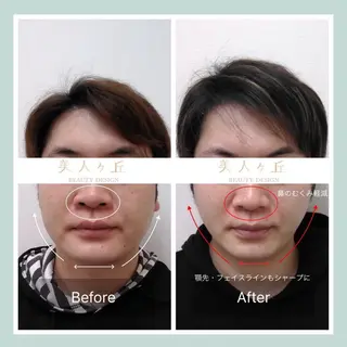 韓国/ヌーディー系 ネイル自由が丘のネイルデザイン