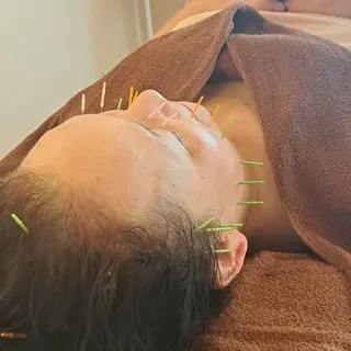 鍼灸サロンmiyabi所属・美容鍼×エステ　鍼灸 サロンmiyabiのエステ・リラクイメージ