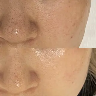 Whitening Beauty 行橋店所属・Whitening Beauty 行橋店のその他イメージ