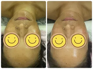 Salon Rion所属・Rion 野々村のエステ・リラクイメージ