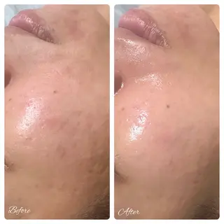 SPA&BEAUTY Shanaのエステ・リラクイメージ