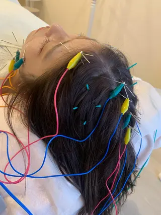 新宿hari-me所属・美容鍼hari-me 新宿のエステ・リラクイメージ