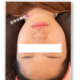 FLEUR大阪・整体 ・ハイフ・痩身・小顔のエステ・リラクイメージ