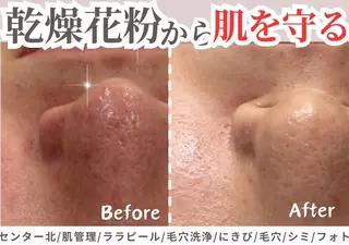 sii センター北 AIのエステ・リラクイメージ