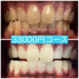 PLATINUM Beauty 横浜店所属・ホワイトニングルーム 横浜店のその他イメージ