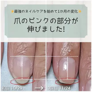 ネイル AKT NAIL所属・AKT Beauty エステヘッドスパのエステ・リラクイメージ