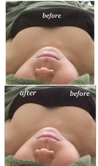 private salon Dea_maris シュガーリング&パーソナルボディケア所属・シミ改善・韓国肌管理 ボディメイク痩身のその他イメージ