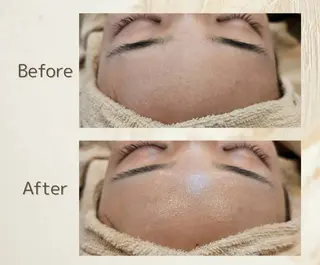 &W アンダブルのエステ・リラクイメージ