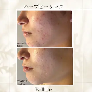 ピーリング専門店 Belluteのエステ・リラクイメージ
