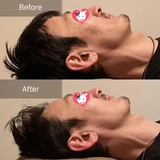 メンズ Ｂ&H所属・頭痛•肩こり専門/ 眉サロンB&H心斎橋のエステ・リラクイメージ