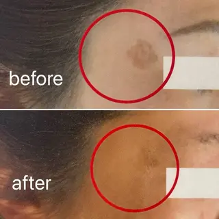 痛くないシミ取り 【荻窪】石橋のヘアスタイル