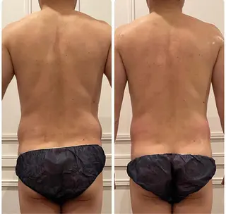 立体小顔×艶肌×美ボ ディ似合わせ施術 岡のエステ・リラクイメージ