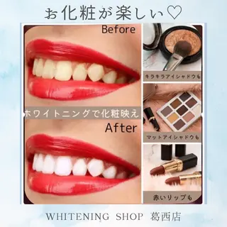 ホワイトニング ショップ葛西店のその他イメージ